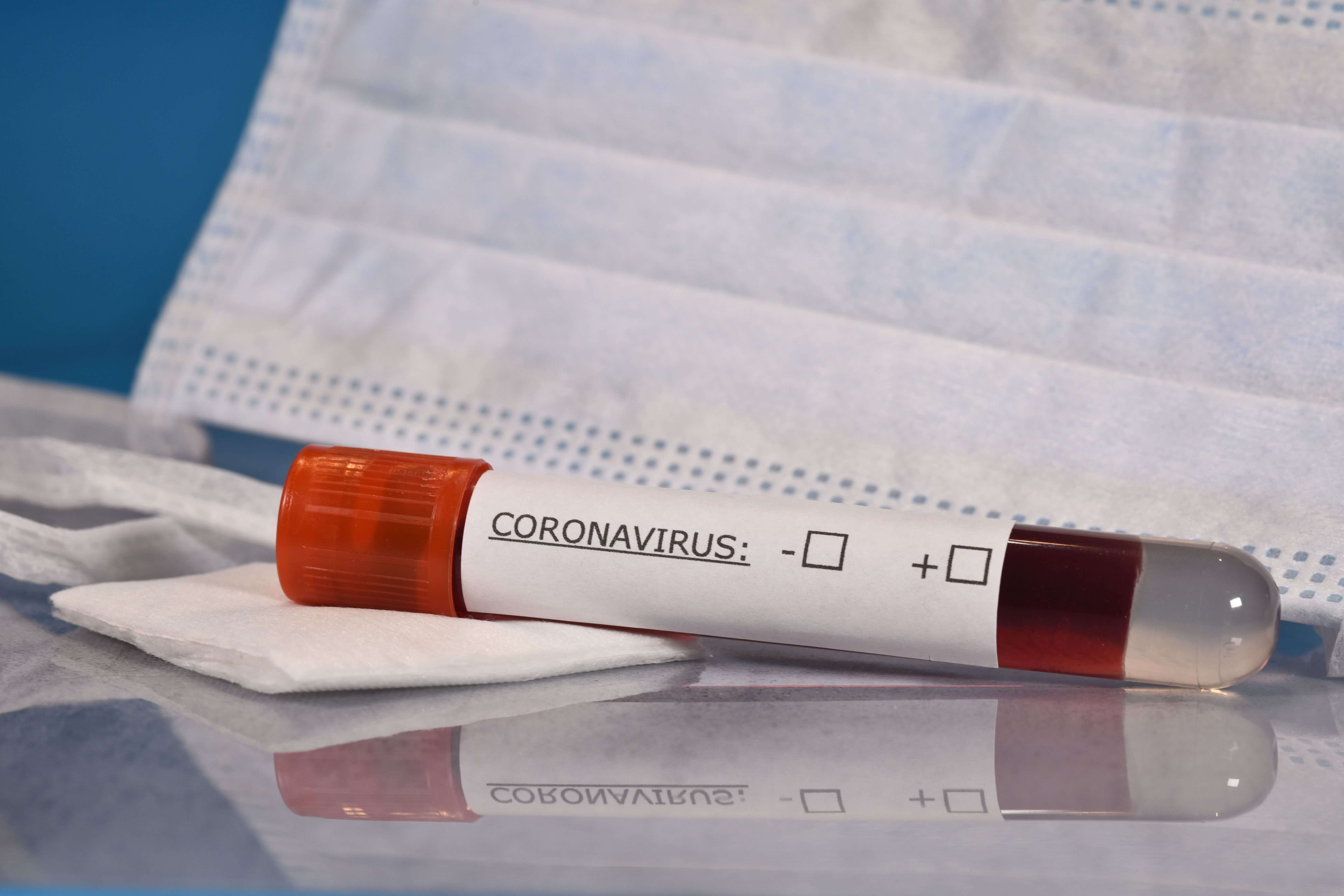 Charleroi: un cas de Coronavirus confirmé dans la région 