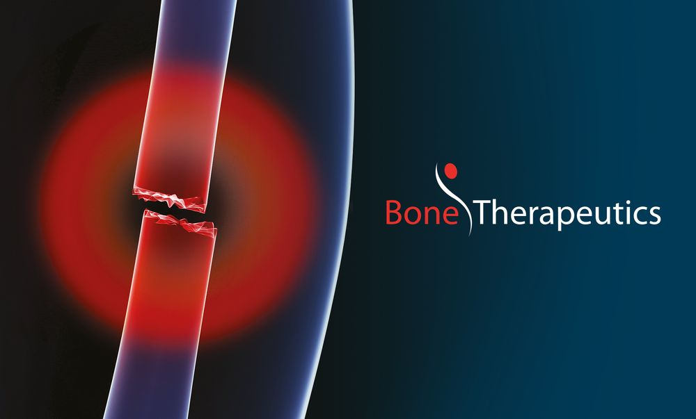 Bone Therapeutics: bonne et mauvaise nouvelle pour la biotech 