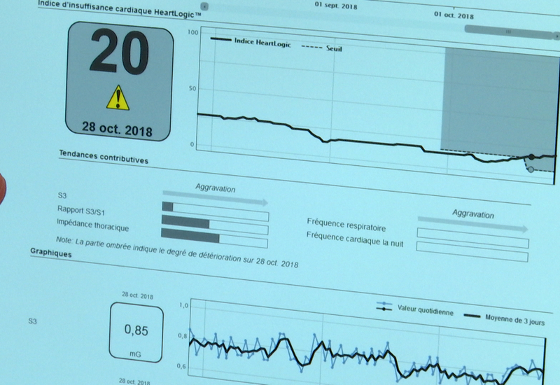 Un service de cardiologie à domicile