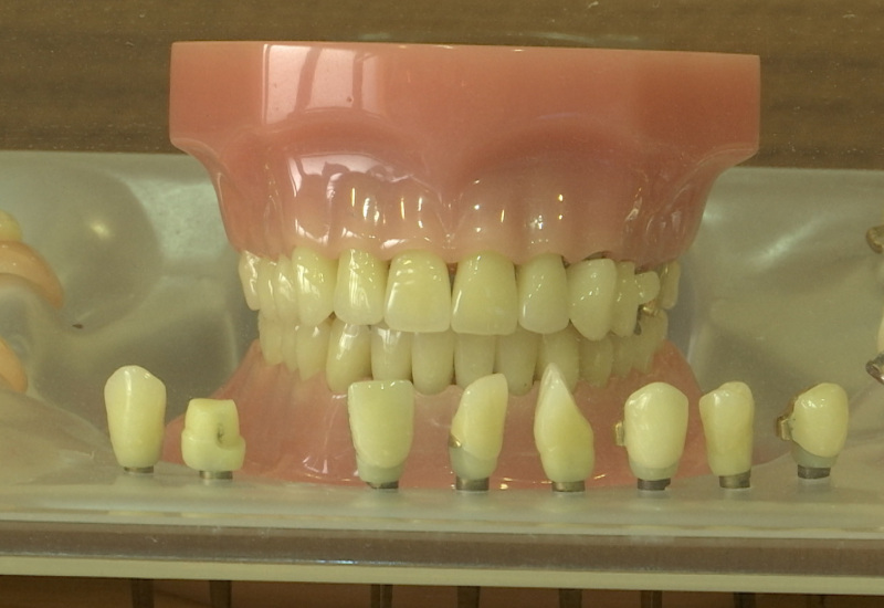 La pénurie d'orthodontistes ne cesse de s'aggraver