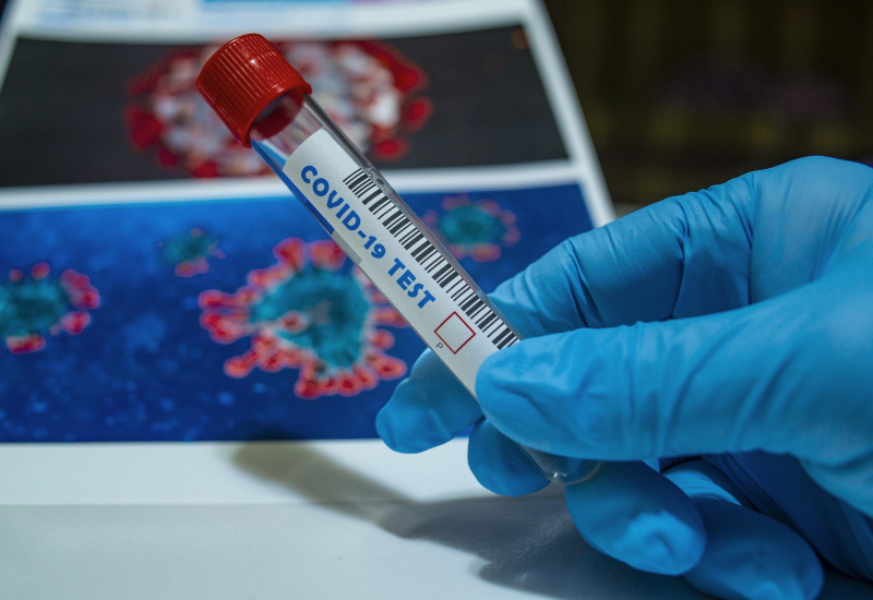 Coronavirus : les contaminations en baisse mais les décès en hausse