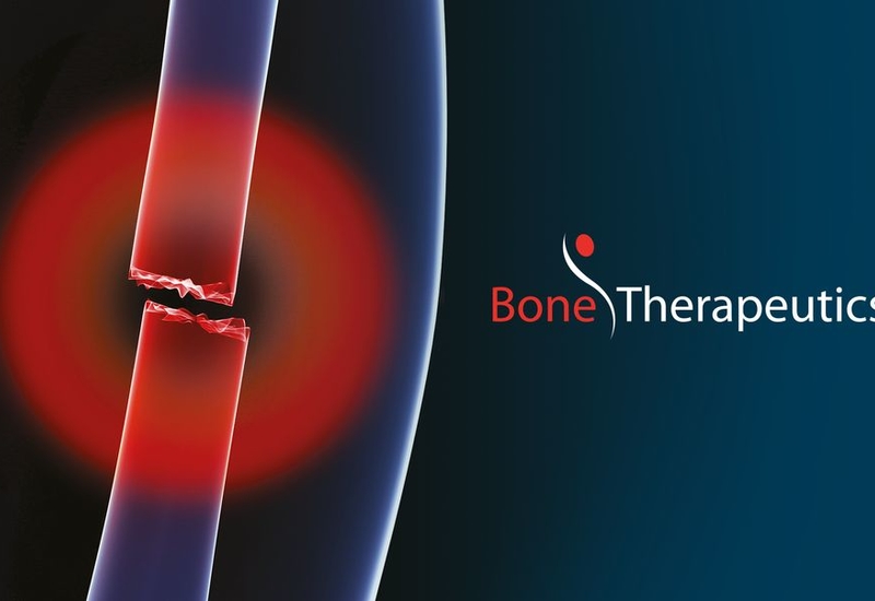 Bone Therapeutics: bonne et mauvaise nouvelle pour la biotech 